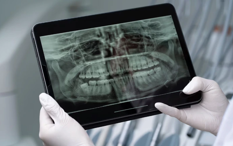 dijital dis hekimlig